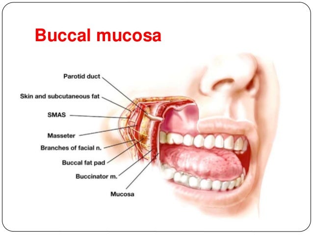 diagram lip mucosa wiring diagram database Labial Mucosa Cancer diagram lip mucosa wiring diagram read carcinoma tongue diagram lip mucosa